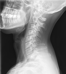 spine