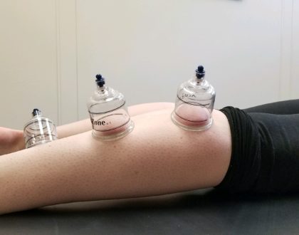 myofascial cupping therapy brookfield